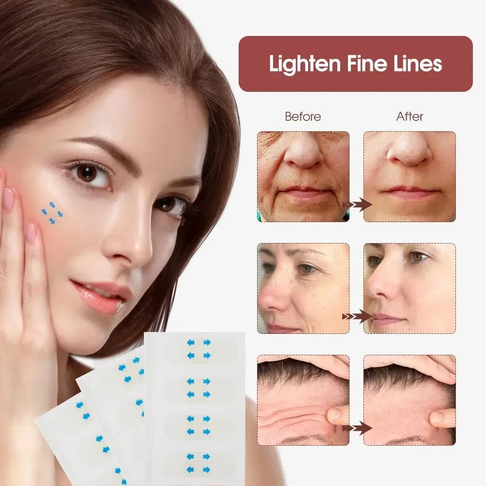 Before and after images showing the effect of lightening fine lines using adhesive patches on the skin.