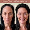 A woman with dark hair is shown on both sides, demonstrating a product for lowering the hairline.