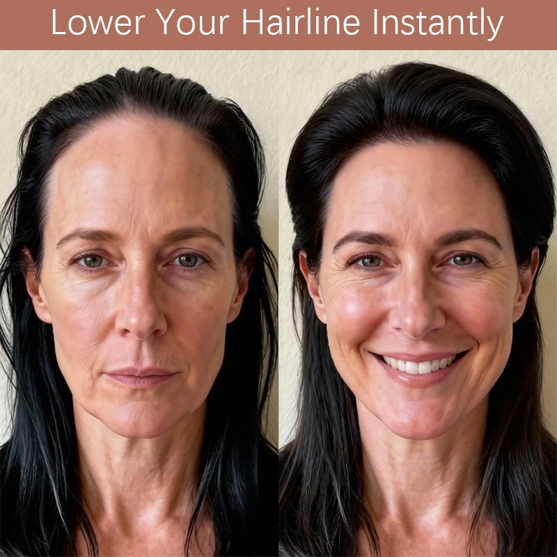 A woman with dark hair is shown on both sides, demonstrating a product for lowering the hairline.
