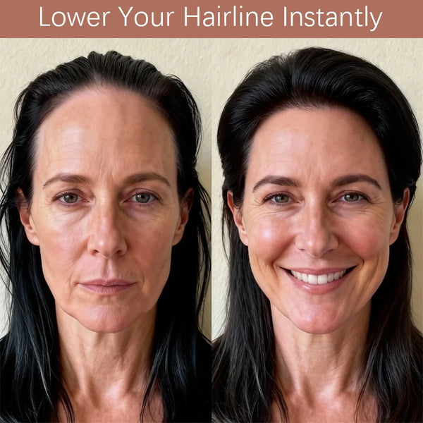 A woman with dark hair is shown on both sides, demonstrating a product for lowering the hairline.