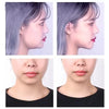 Close-up images showing invisible V-shape face lifting adhesive patches applied to the side profile and front of a woman's fa